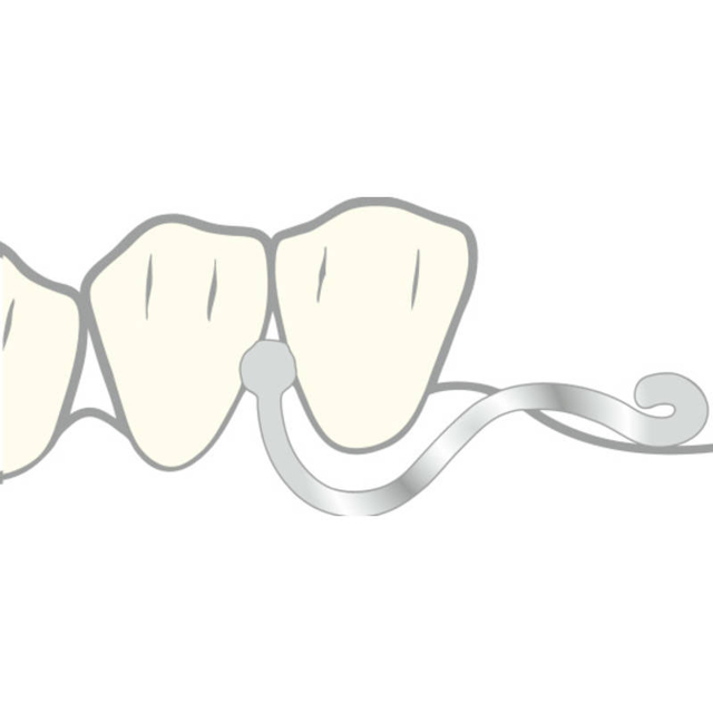 Scheu Anker 0,9 mm, 10 stk