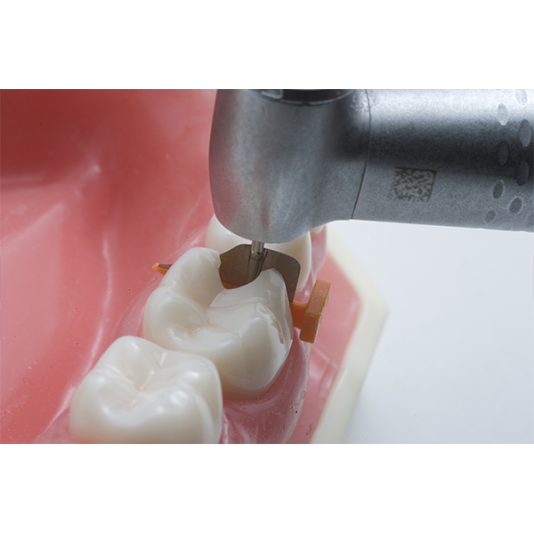 FenderWedge lilla, x-small, 36 stk.