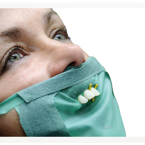 Dry Dam Kofferdam, medium, 25 stk.