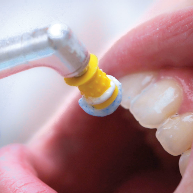 ProphyCare HAp pudsepasta, 60 g 