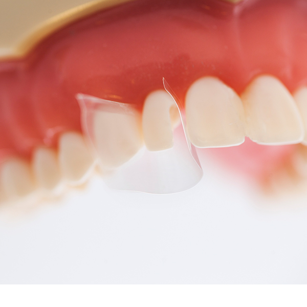 Directa ProxyPal, 36 stk.