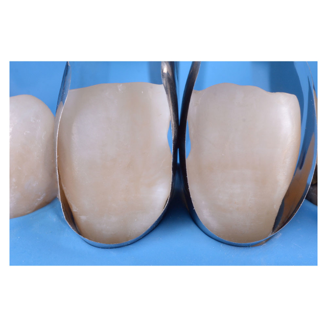 Unica minideep anterior matricer, 50 stk.